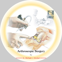 Arthroscopic-Surgery-cd
